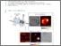 [thumbnail of Wilner-etal-AC-2018-Surface-enhanced-Raman-scattering-SERS-based-microfluidics]