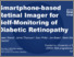 [thumbnail of Shand-etal-EURetina-2023-Smartphone-based retinal imager for self-monitoring-of-diabetic-retinopathy]