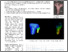 [thumbnail of Asadirad-etal-BioMedEng-2022-The-effect-of-image-threshold-level-on-patient-specific]